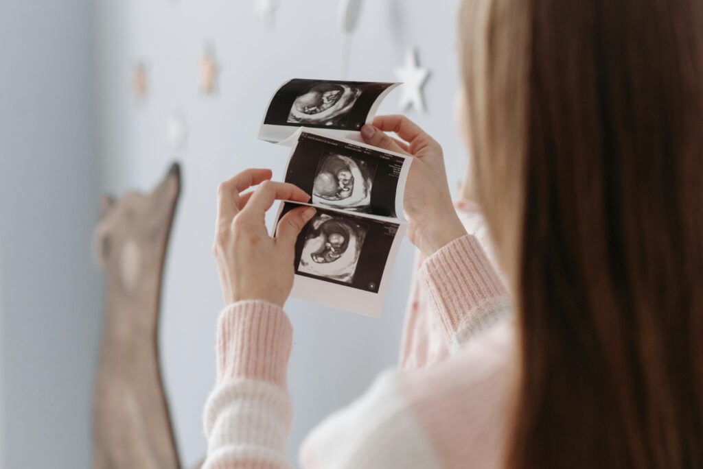 A woman looks at ultrasound photos